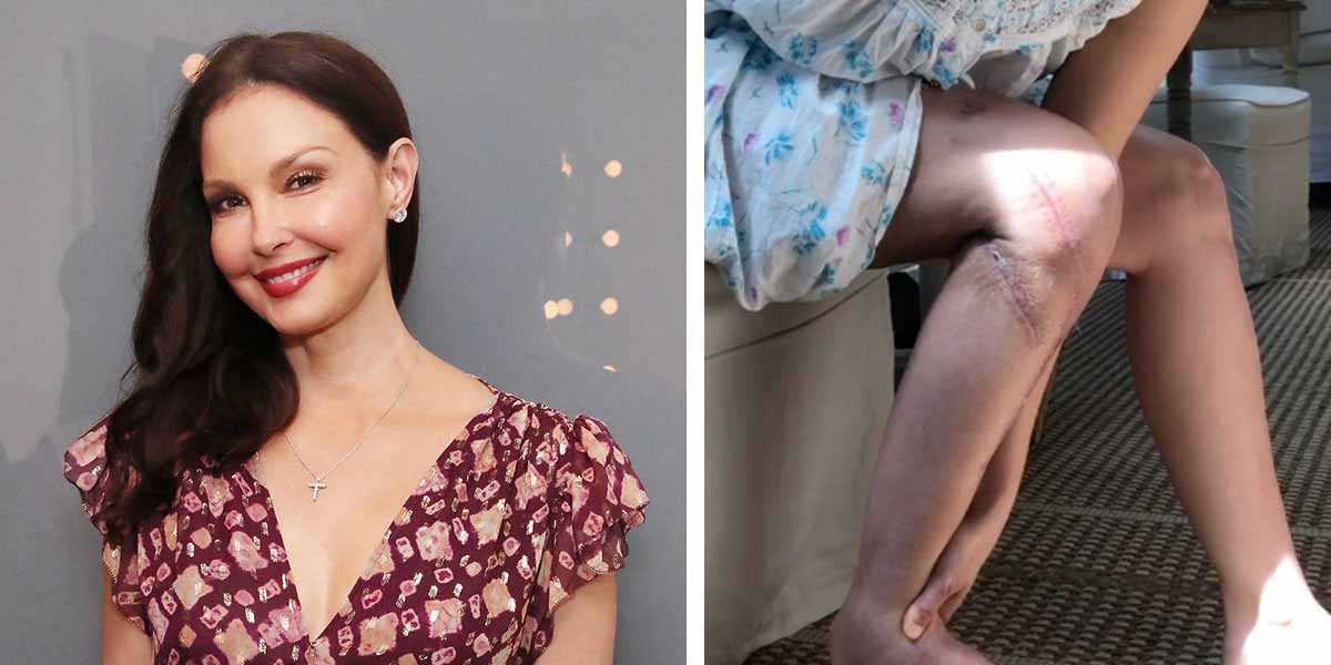 Ashley Judd Back on her feet
